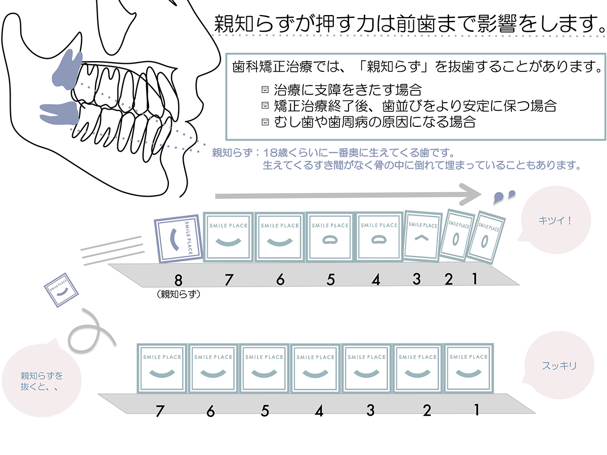 親知らず