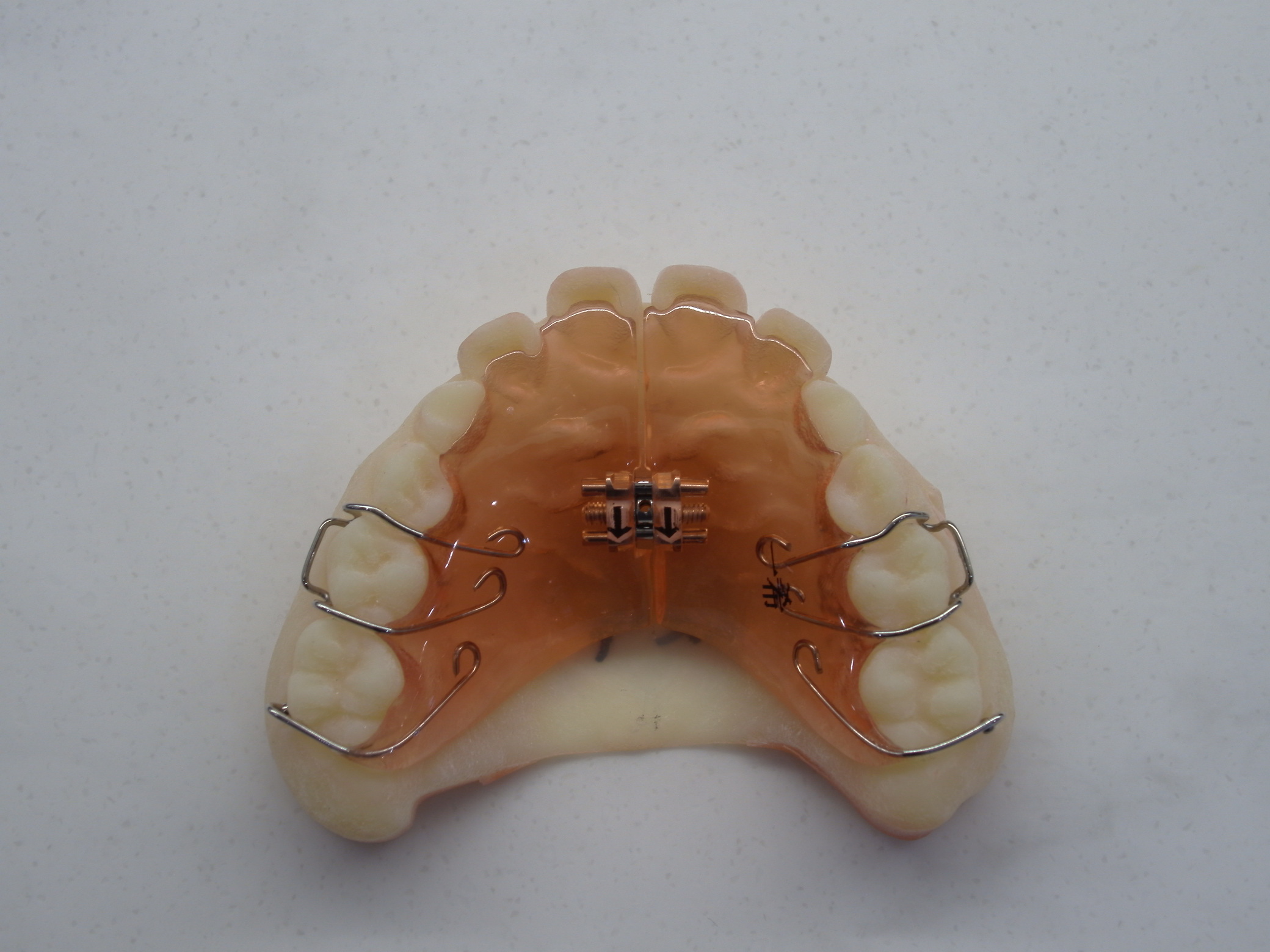 SHOFU DENTAL DIGITAL CAMERA｜文京区の矯正歯科 スマイルプレイス本郷矯正歯科